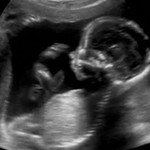 お腹の中の赤ちゃんの様子を、VRで見られるようになる？