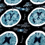 妊娠すると脳は実際に変わる：研究結果